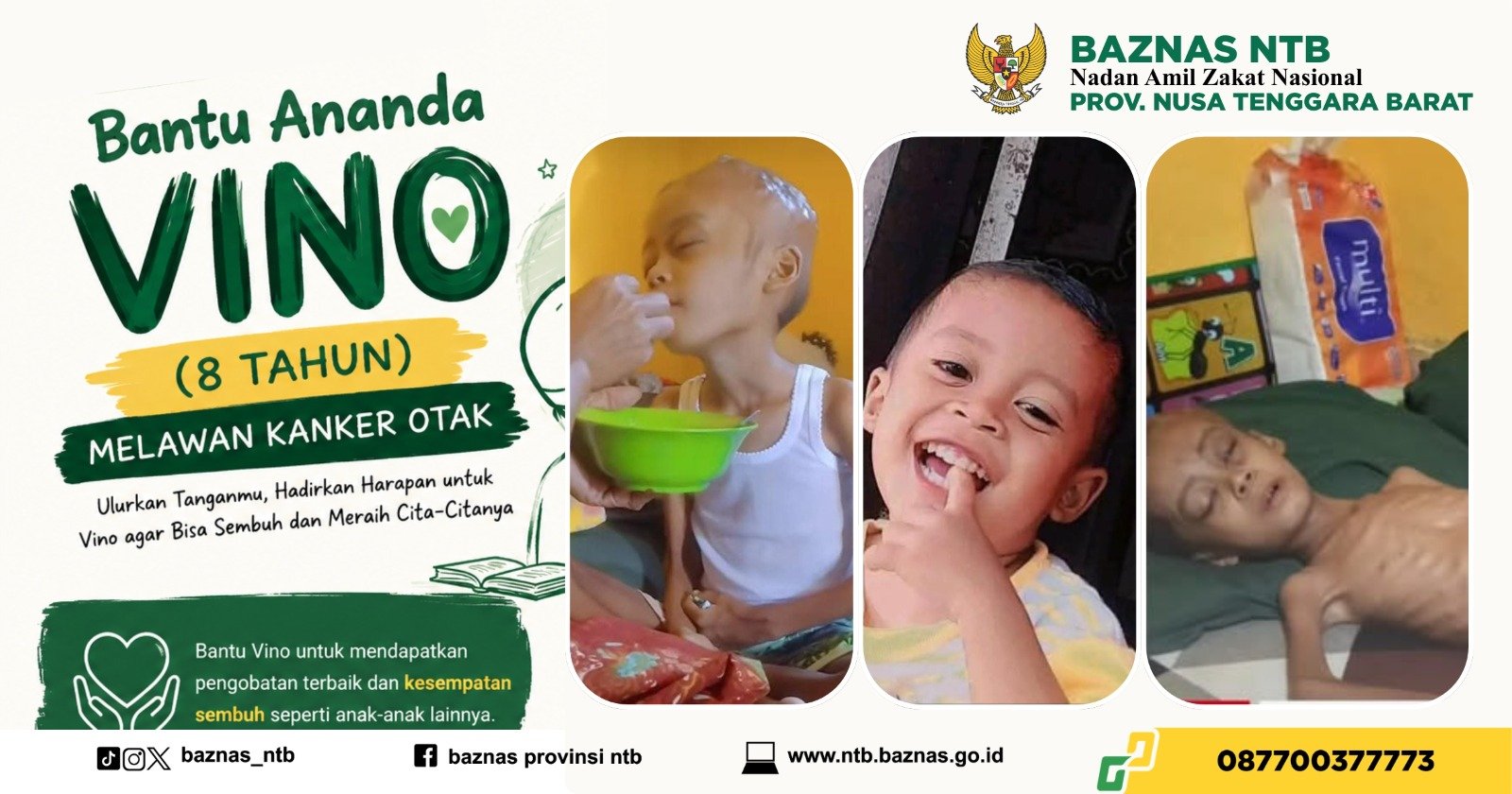 Bantu Adek Vino (8 Tahun) Melawan Kanker Otak